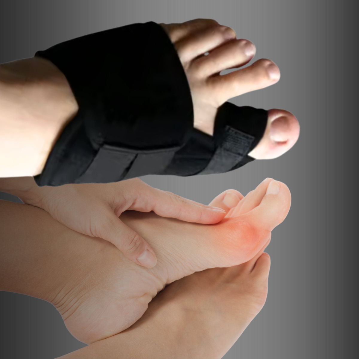 BLACKHALLUX™ - Corrector de juanetes (1 par)